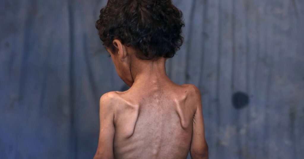European powers urge end to Gaza ‘humanitarian catastrophe’